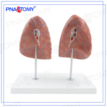 PNT-0475 human model of left and right lung model